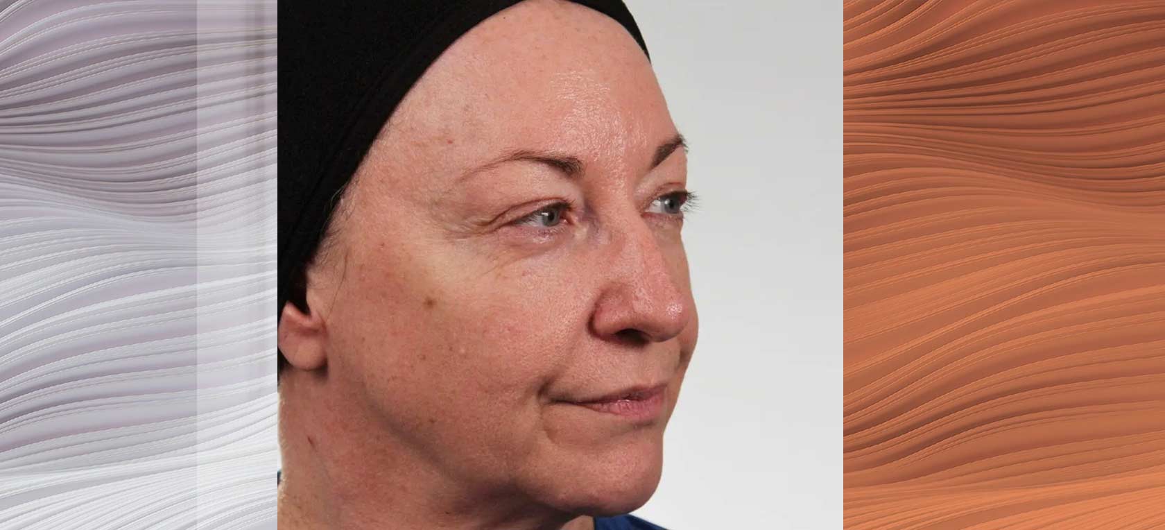 Post-Hero-Clinical-Results-02