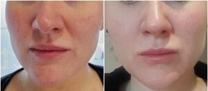 Images courtesy of The Skin Sanctuary, Doncaster