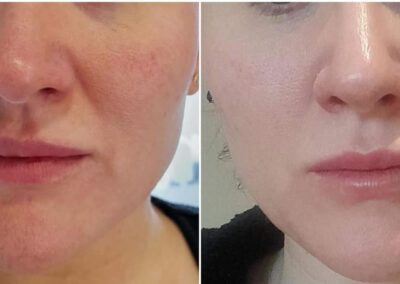 Images courtesy of The Skin Sanctuary, Doncaster