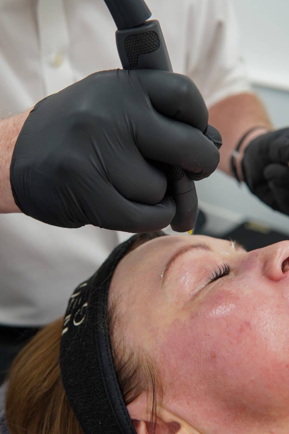 NeoGen handpiece treating the brow and upper eyelid of a patient wearing a NeoGen headband