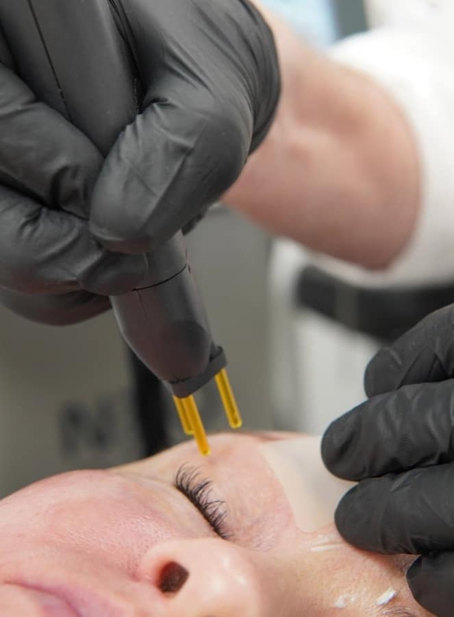 Gloved practitioner holding a NeoGen handpiece with gold tips close to a client’s face