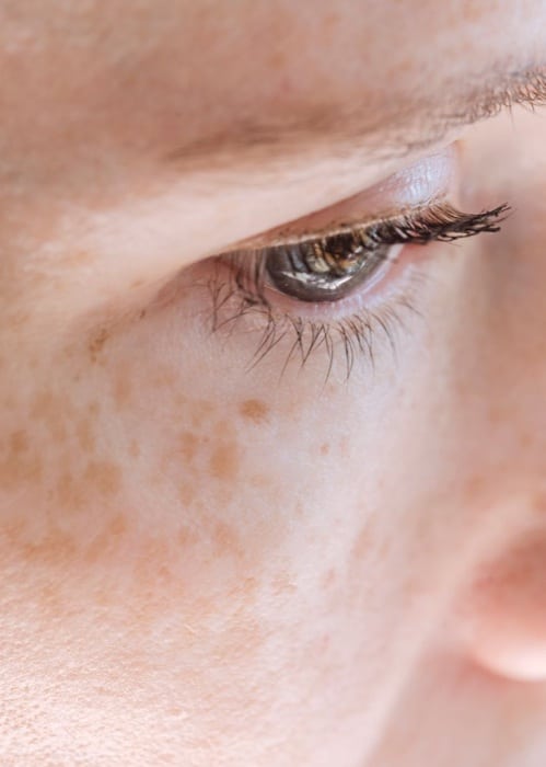 Macro close-up of a woman’s eye and the freckled skin beneath it