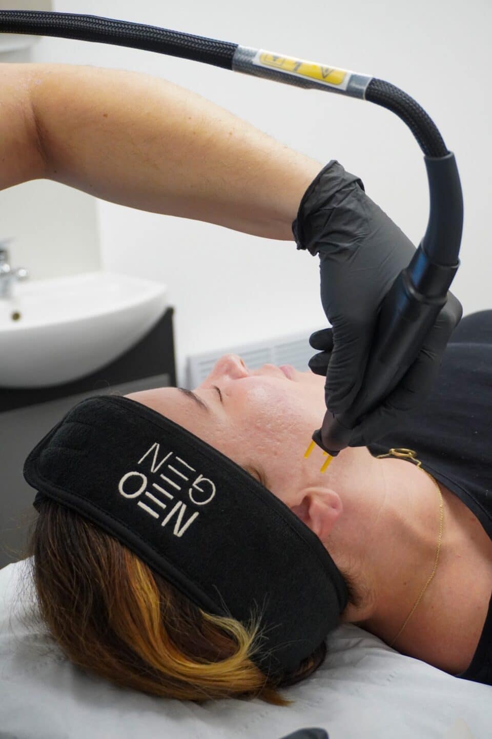 Patient in a NeoGen headband having the lower face treated with the NeoGen handpiece