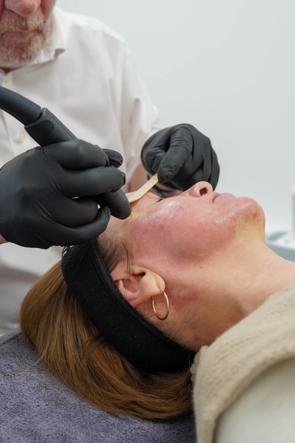 Practitioner treating the skin of a patient’s cheek below the eye with the NeoGen handpiece