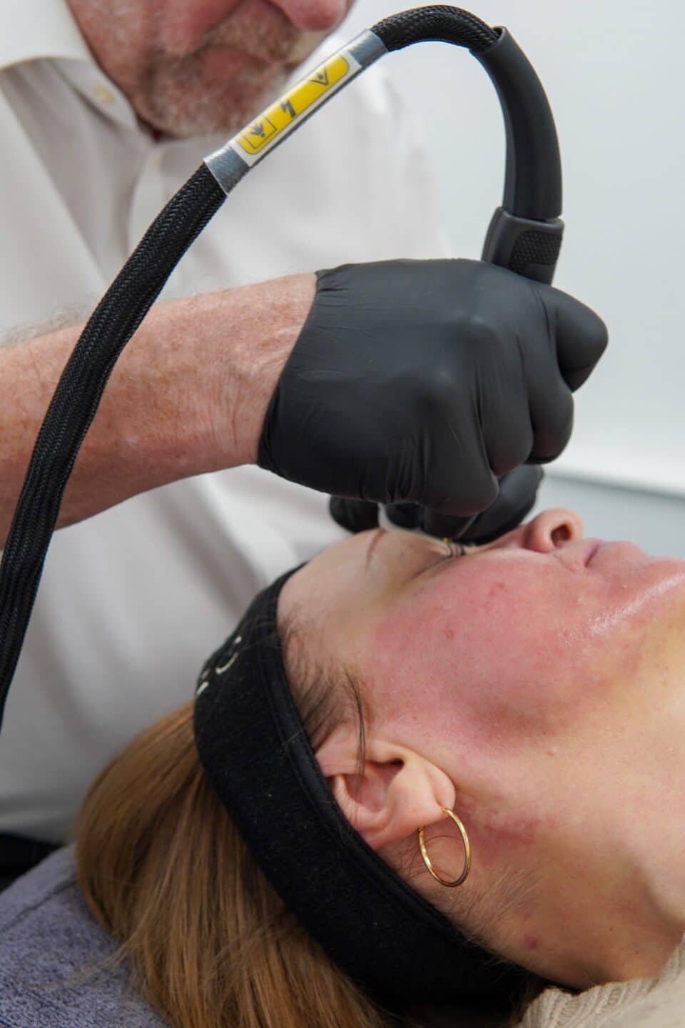 Practitioner using the NeoGen handpiece on the upper face of a patient lying back